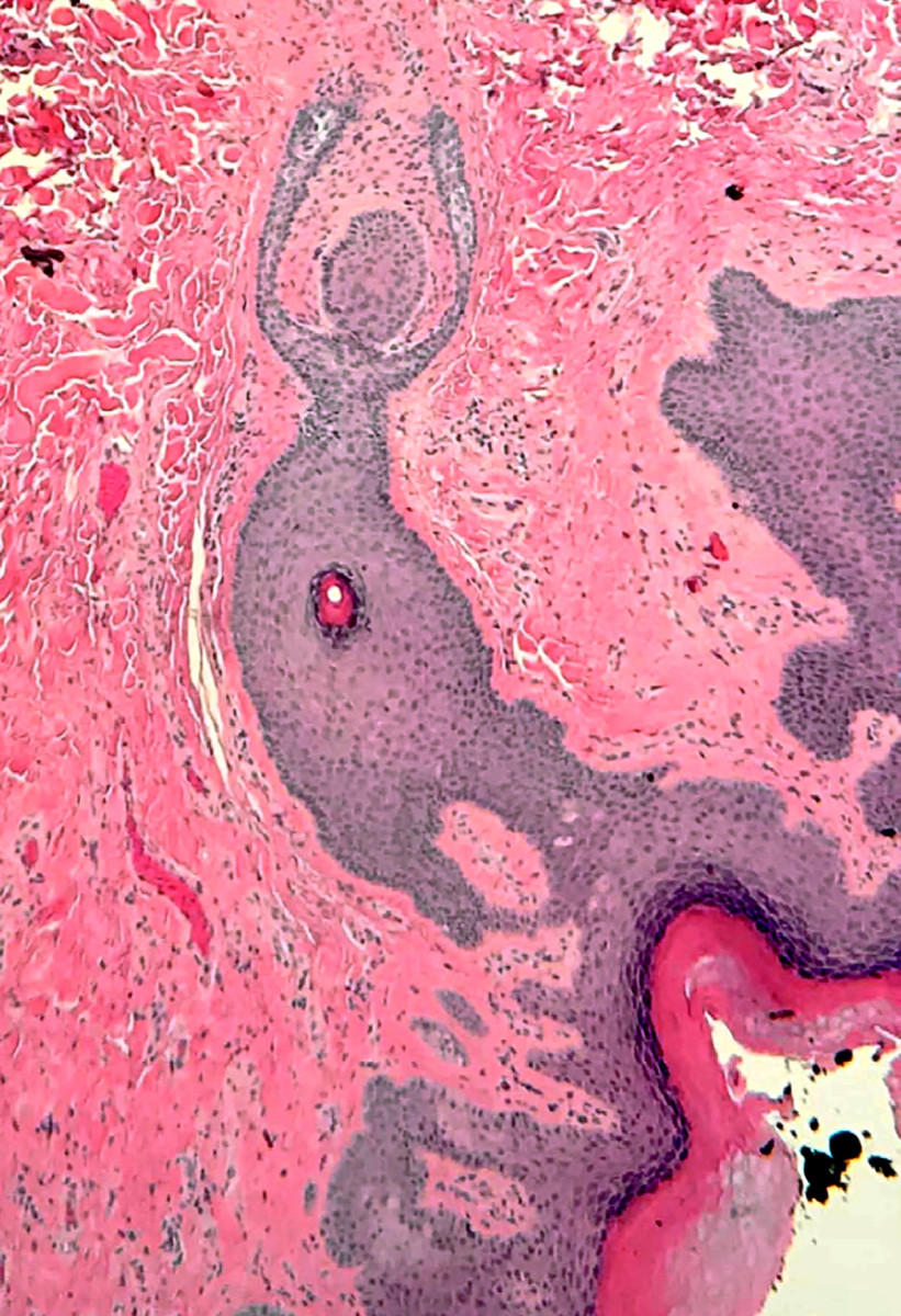 Illustration pour le poème